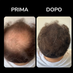 Key-S Luxury Microfibers Full 3D Hair Fiber Black 25 Gr. - Microfibre di Cheratina Naturale - immagine 2